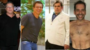 Famosos e Cirurgia Bariátrica