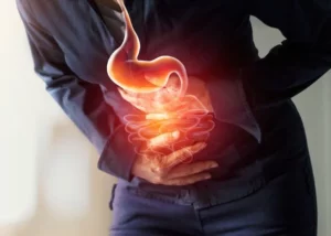 Refluxo gastroesofágico e obesidade - Cirurgia bariátrica Goiânia